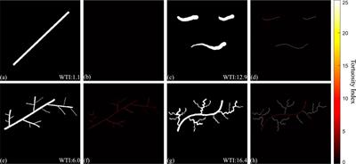 Quantitative assessment of the oral microvasculature using optical coherence tomography angiography